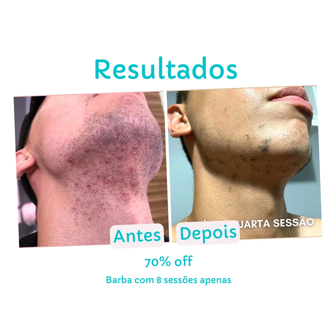 Resultado Barba