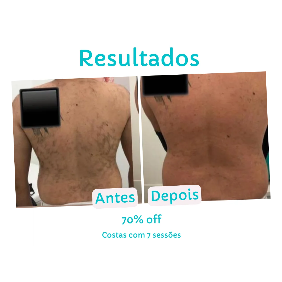 Resultado Costas