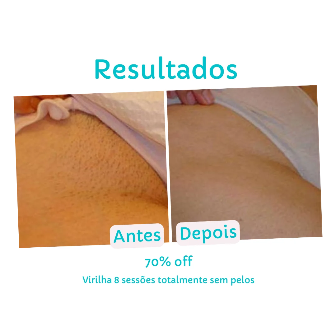 Resultado Virilha
